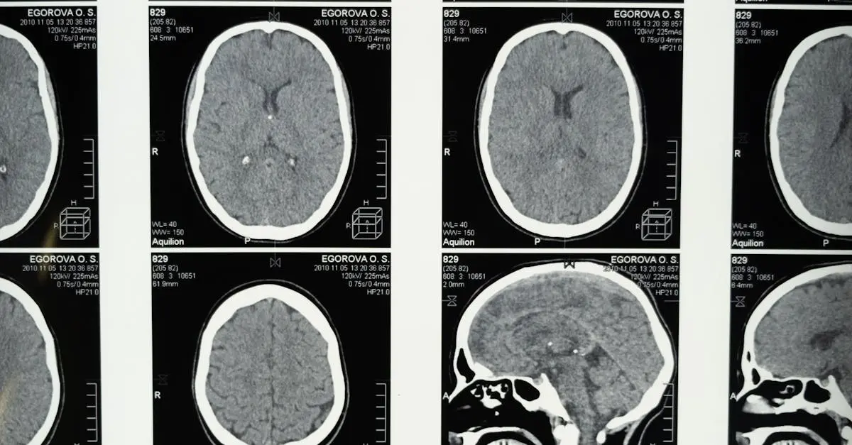Quiz image for: Basic Brain Anatomy