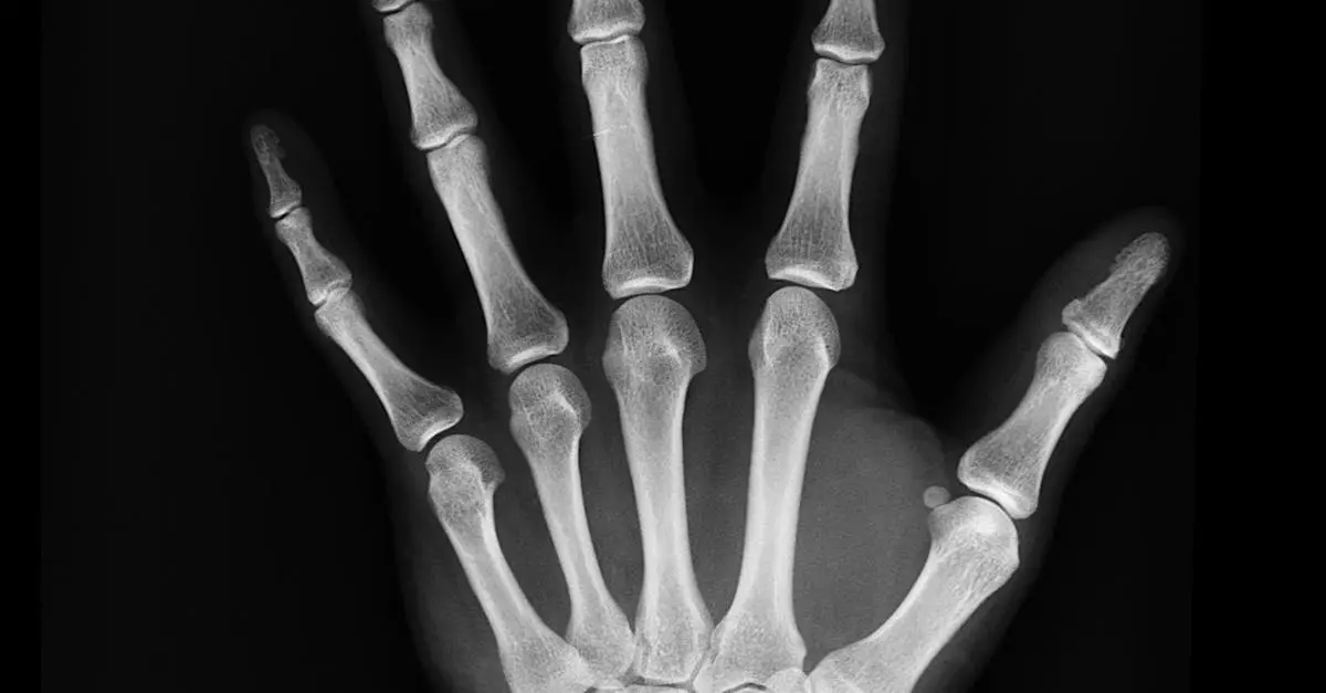 Quiz image for: Common Joint Types